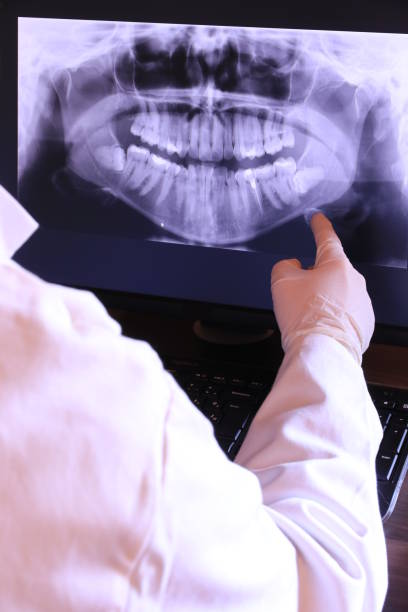 Best Emergency Care for Gum Disease in Fredericksburg, IA