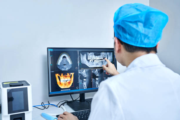 Best Knocked-Out Tooth (Avulsed Tooth) Treatment in Fredericksburg, IA