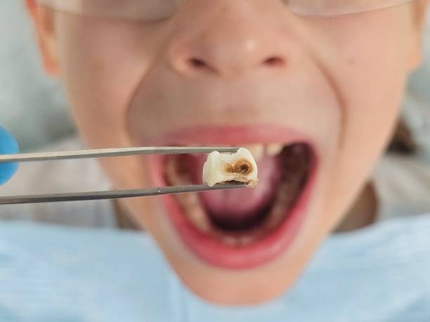 Best Emergency Denture Repair in Fredericksburg, IA
